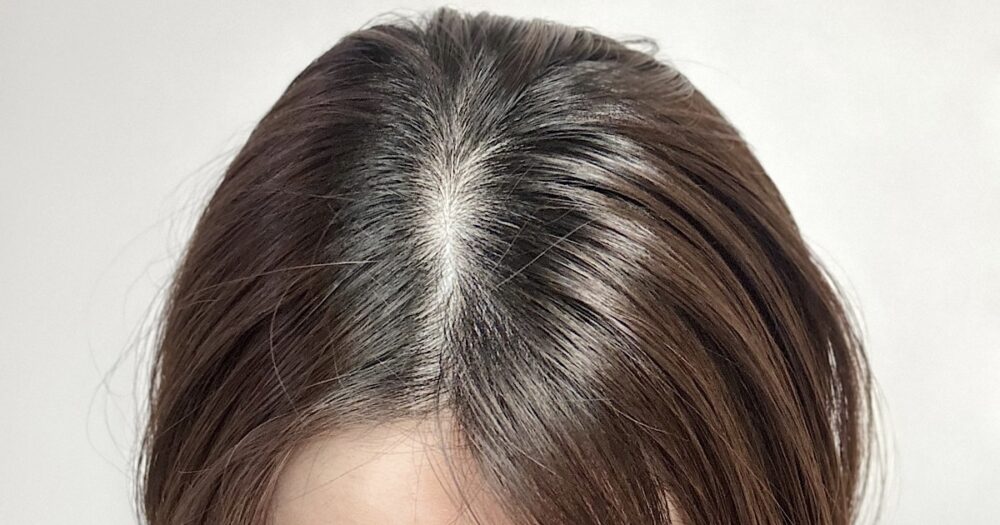 髪のボリューム低下