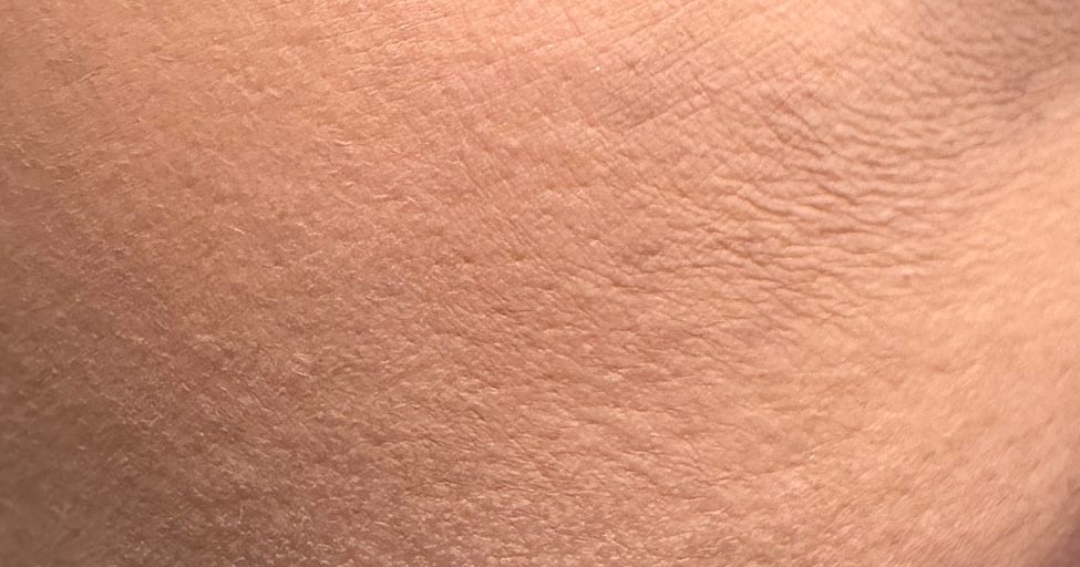 乾燥悪化　拡大図